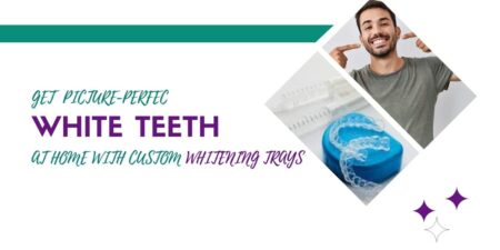 Get Picture-Perfect White Teeth at Home with Custom Whitening Trays